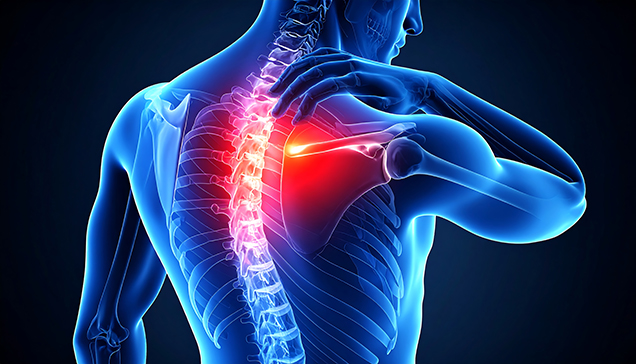 Shoulder / Upper Back Tightness