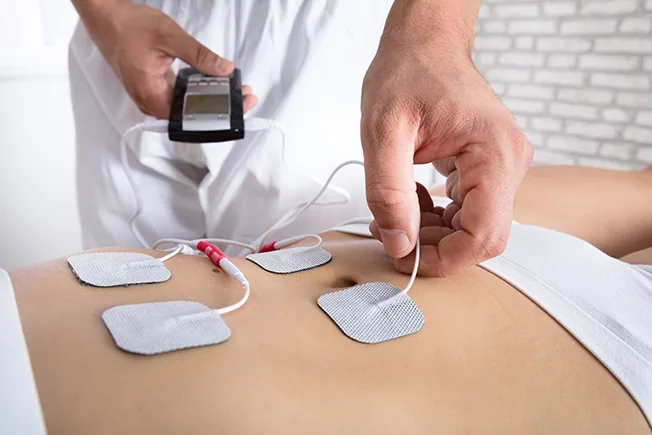 Electric Stimulation